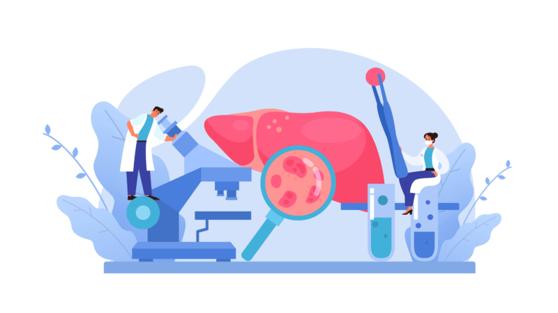 Doctors checking liver health