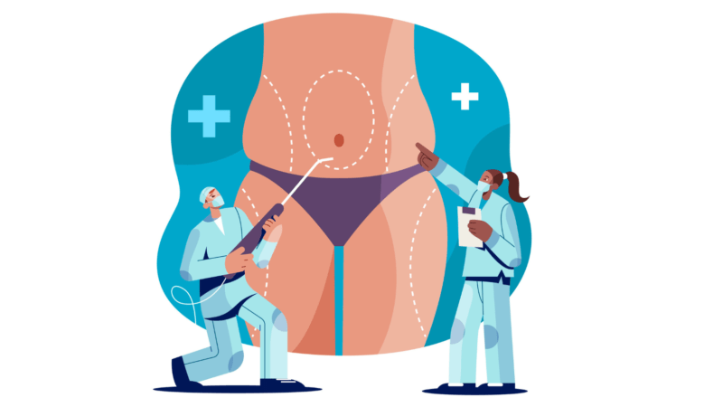 Laparoscopic Surgeons